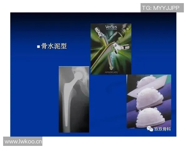 诺伊尔反思失球原因：错误决定与第二落点的失误分析